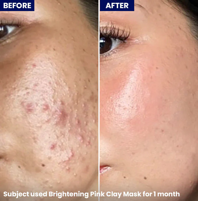 Brightening Pink Clay Mask - Image 5