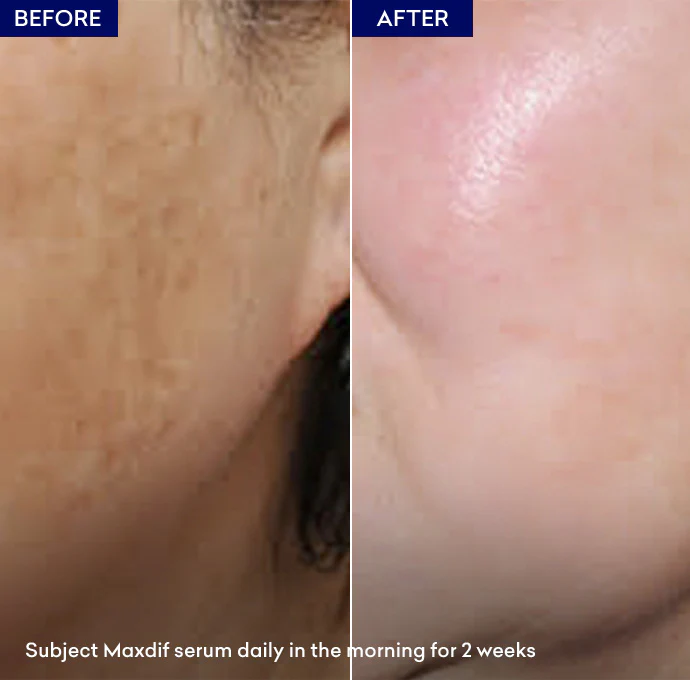 Maxdif Brightening Serum - Image 5